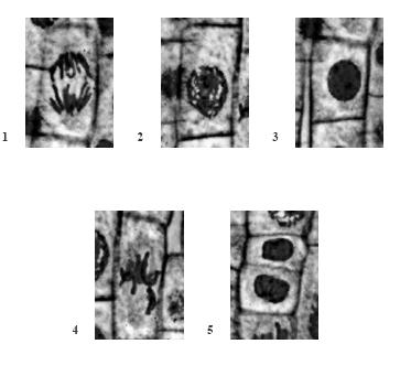 12) a) Identifica as fases da mitose en que se atopan as células de cada unha das micrografías da folla adxunta. B) En que orde as colocarías para que se corresponderan co orde temporal da mitose?