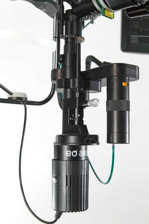 Tailored to your needs Our slit lamp adapters are bespoke designs for each slit lamp model, thus guaranteeing the sharpest focus possible during treatment.