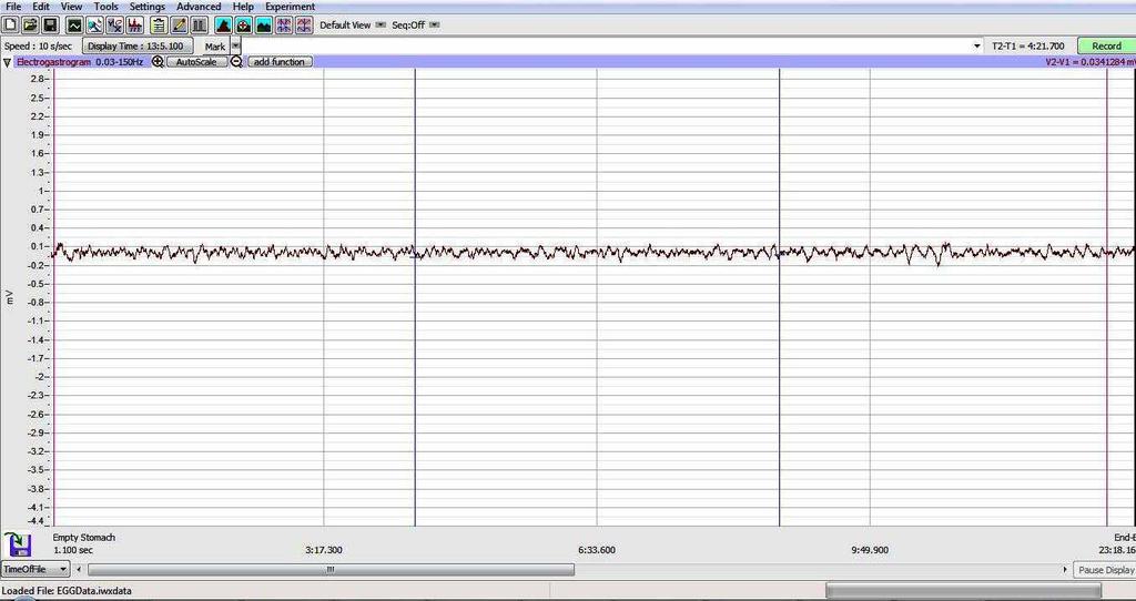Figure HM-3-L1: The EGG recording in the Main window of a supine subject with an empty stomach. Note the fluctuations in muscle activity over the course of the recording.