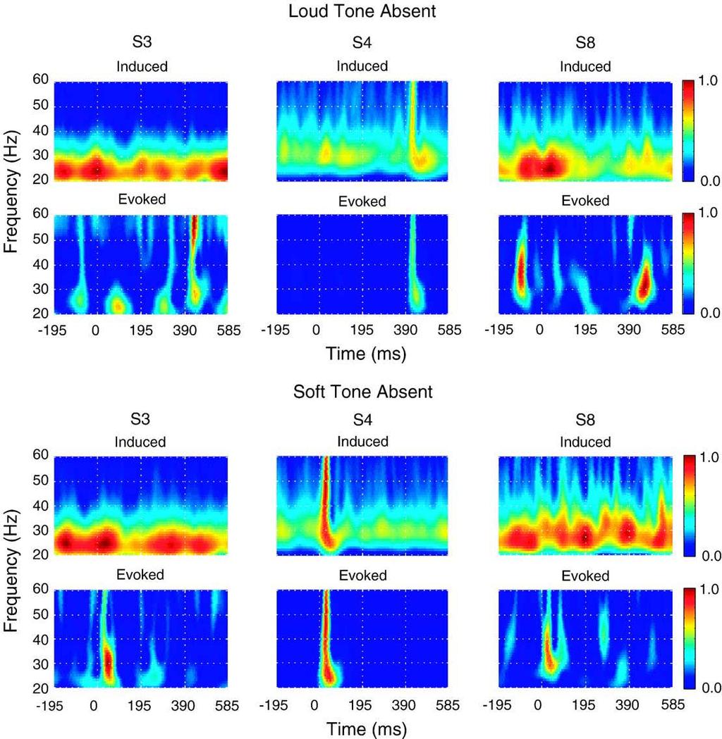 124 J.S. Snyder, E.W. Large / Cognitive Brain Research 24 (2005) 117 126 Source: Snyder, J. S., and E. W. Large. "Gamma-band Activity Reflects the Metric Structure of Rhythmic Tone Sequences.