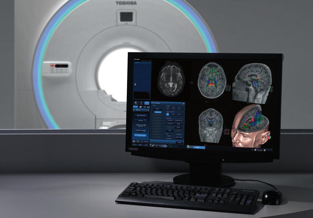 Advanced post-processing as easy as 1-2-3 Advanced post-processing functions such as fmri, spectroscopy, diffusion or tensor tractography can be