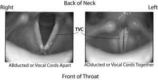 Phonation Phonation the sound made by the vibration of vocal folds modified by the resonance of the vocal tract.