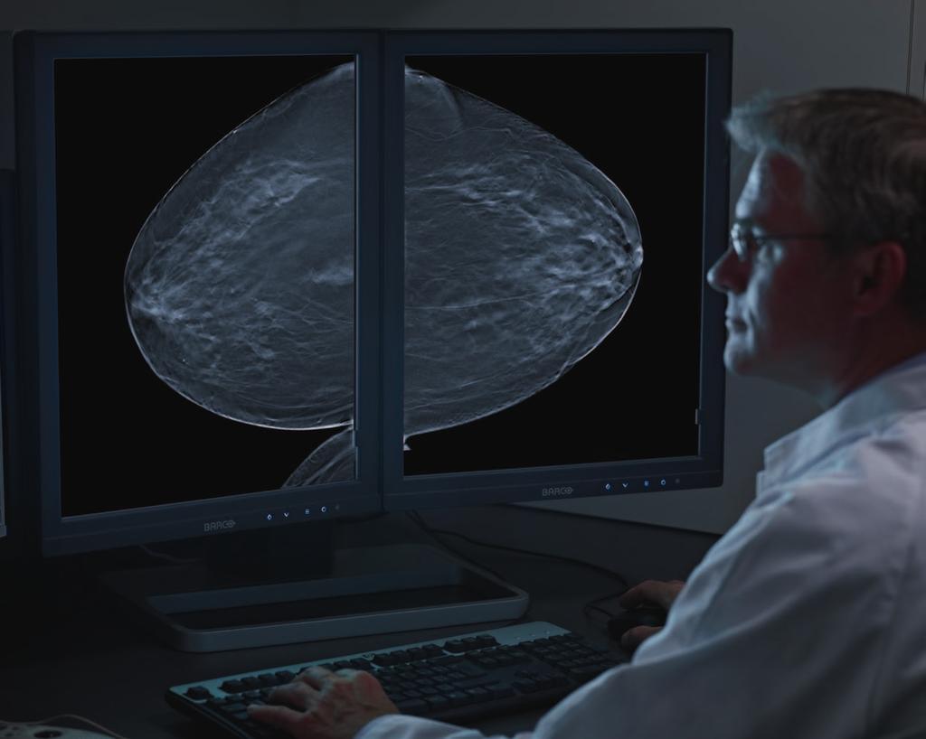 The first choice for digital breast tomosynthesis Barco s reputation for accuracy and dependability is the result of extensive clinical and technological research, along with a strong emphasis on