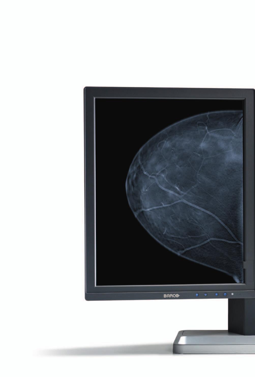 Technology that makes the difference Barco s Mammo Tomosynthesis 5MP proves that technology can make a real difference.