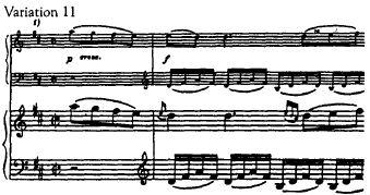 Florid and richly ornamented, Variation 11 changes tempo to adagio cantabile, and most editions offer the autograph for comparison.