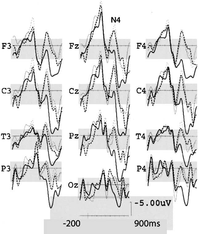 154 B R A I N R E S E A R C H 1 0 6 8 ( 2 0 0 6 ) 1 5 1 1 6 0 Fig. 2 Response time according to saliency and. P b 0.000) and an electrode saliency interaction (Rao R (22,8) = 3.27 P = 0.044). 2.1.1. N400 component ANOVA including an electrode factor (F (11,319) = 9.