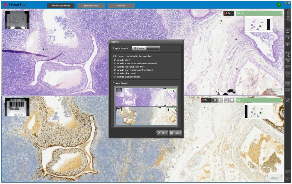 As the VisionTek is a live digital microscope, there is no need to store all the slides before viewing. Every case can be diagnosed live, without wasting scanning time and server space.