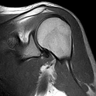 Superb Image Quality Thanks to Esaote s long term experience in Dedicated Extremity MRI, and the