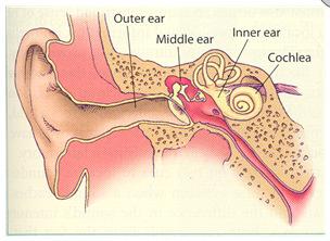 Objective tinnitus (not a complete overview) Myoclonus Palatum Middle ear muscles Vascular origin Vascular malformation Carotic stenosis Sinodural fistula 16/92 Pulsatile tinnitus (not a complete