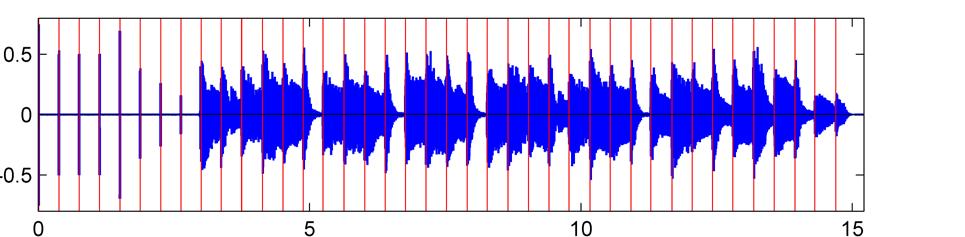 de ABSTRACT This paper addresses the question how music information retrieval techniques originally developed to process audio recordings can be adapted for the analysis of corresponding brain
