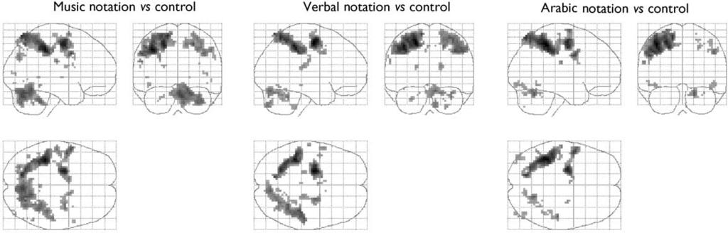 AN fmristudyof MUSIC SIGHT-READING RESULTS As expected, T contrasts between each playing condition and its own control showed that non-specific visual processing common to the control and the