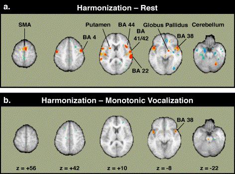 Fig. 4. Axial views of cerebral blood flow changes during Harmonization contrasted with (a) Rest, and (b) Monotonic Vocalization.