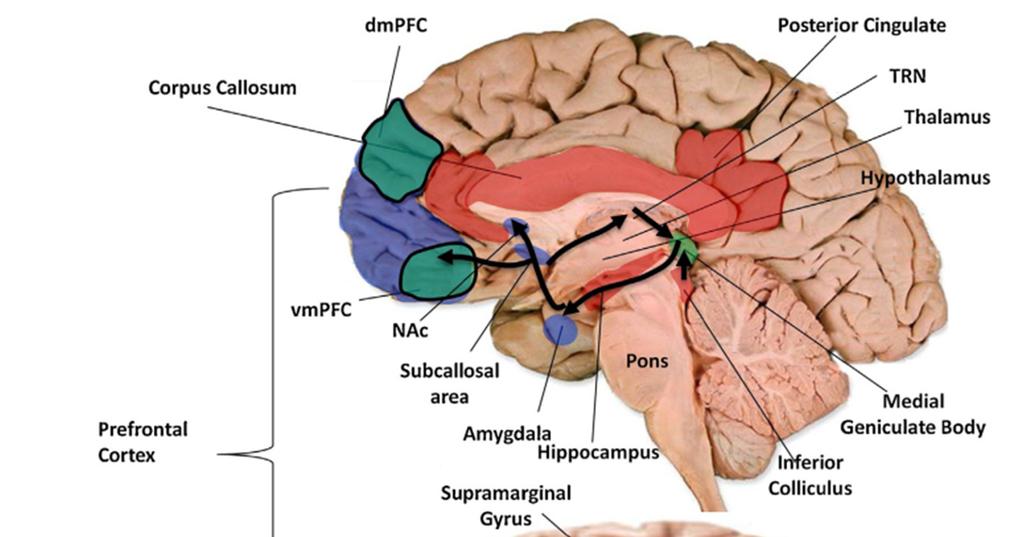 Neuroanatomical