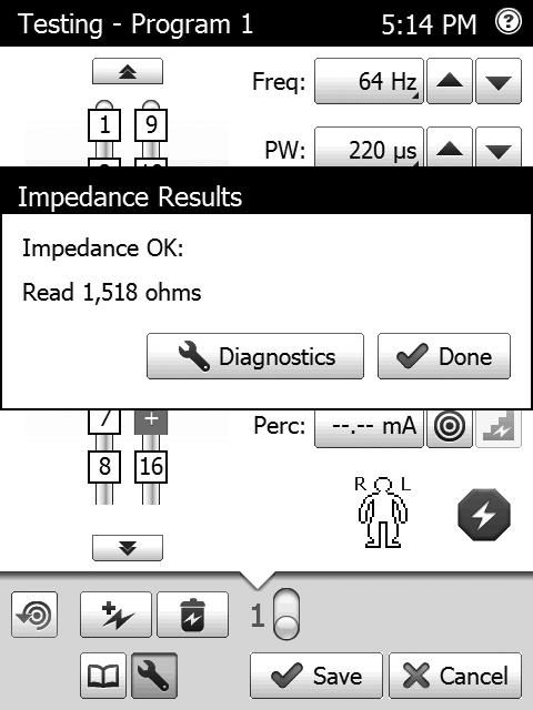 2. If the option is available, tap Diagnostics in the Impedance Results dialog box to get diagnostic details for the entire lead configuration.