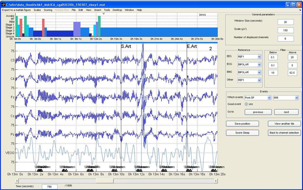 4 MAIN FUNCTIONS OF THE TOOLBOX 22 Figure 11: Sleep scoring GUI, with the hypnogram display on top of the the EEG signal. The keypad is used to assign a score to the current window.