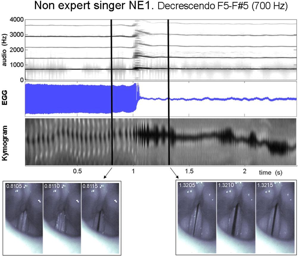 FIG. 8. (Color online) A decrescendo produced by singer NE1 on pitch F5 F5#. Top panel: spectrographic sound analysis. Middle upper panel: EGG signal.