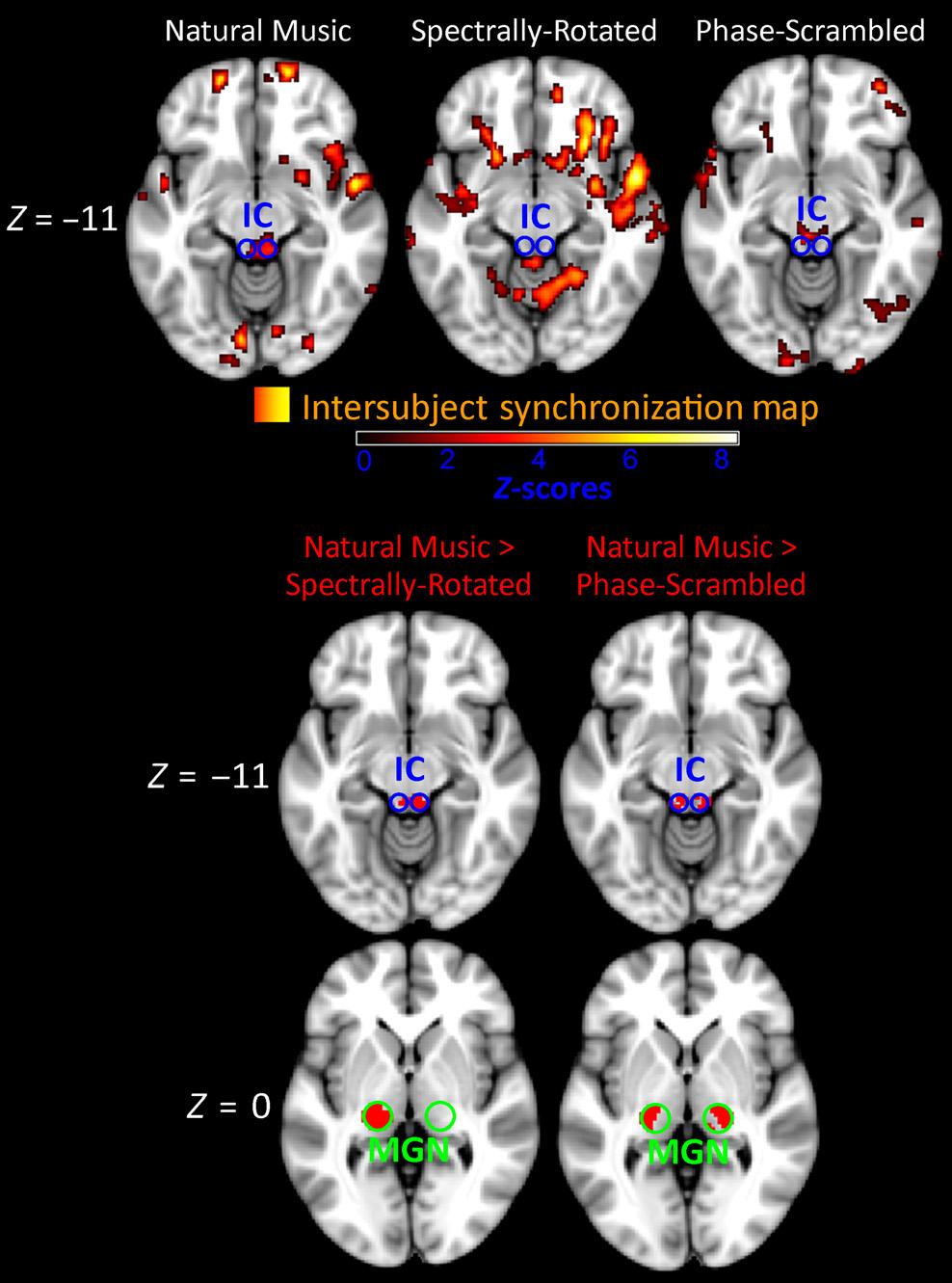 1462 D. A. Abrams et al. Table 1. Peak ISS Z-Scores for the Natural Music condition Brain region Maximum Z-score, Natural Music x y z A Left IC 3.038 2 34 10 IC 4.920 6 32 8 MGN 3.
