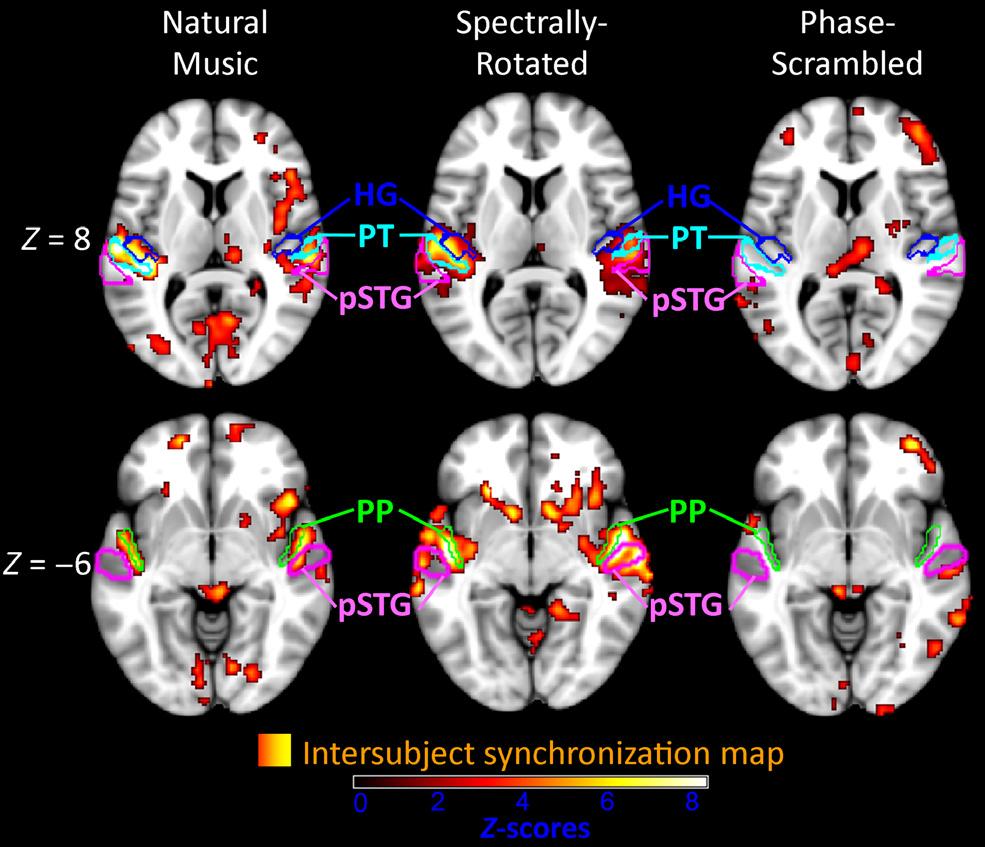Results indicate ISS for Natural Music in right hemisphere IFG, including BA 45 and 47, and parietal cortex, including the PGa subregion of the angular gyrus and the superior parietal lobule (SPL).
