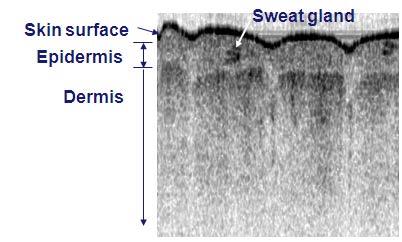 Fig. 3 OCT image taken by this product of upper layers of the skin (finger) (2) High-performance wavelength swept light source using a KTN light deflector The newly developed wavelength swept light