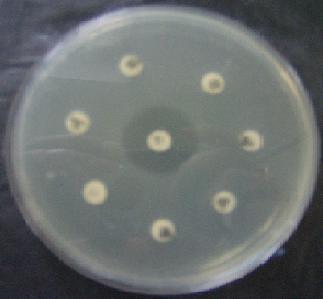 rezistentă la restul antibioticelor testate (foto 13); Foto 13. Tulpină sensibilă doar la imipenem (centru) - cazul nr 3 enterită cu E.