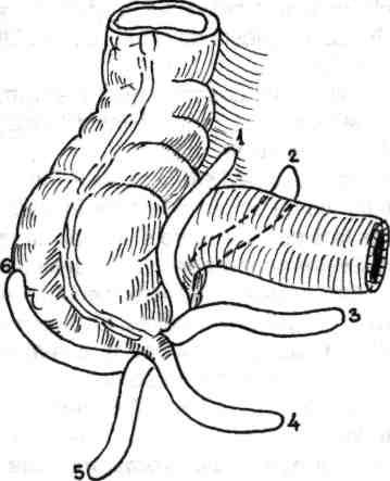 Chirurgia colonului, rectului şi canalului anal Apendicele poate fi liber (mobil) sau fixat.