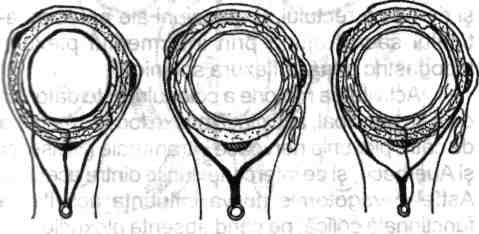 Anatomia chirurgicală a colonului, apendicelui, rectului şi canalului anal 19 medii) şi ramuri descendente (care se anastomozează cu ramuri ale arterelor sigmoidiene).