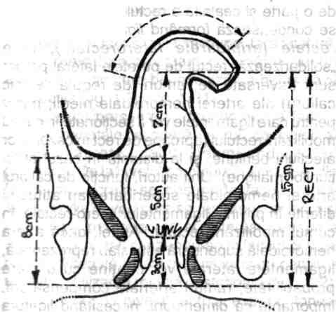 Anatomia chirurgicală a colonului, apendicelui, rectului şi canalului anal 21 
