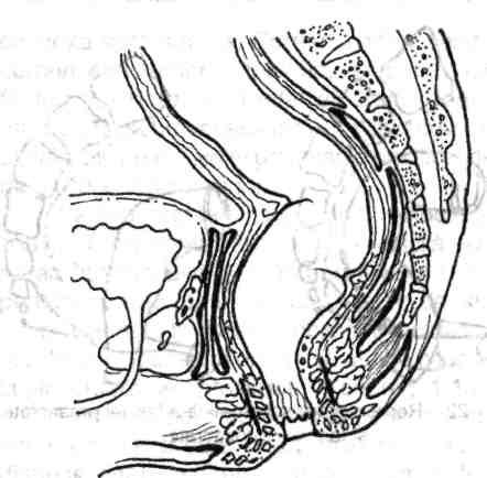 24 \mvs\ Chirurgia colonului, rectului şi canalului anal Fig. 1.23 - Raporturi anatomice ale rectului la bărbat - secţiune sagitală a rectului şi canalului anal.