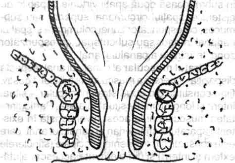 /' şi canalului anal 25 baza spre anus şi cu vârful pierzându-se spre ampula rectală; ele conţin câte un fascicul de fibre musculare longitudinale, precum şi ramuri arteriolare şi venoase din vasele