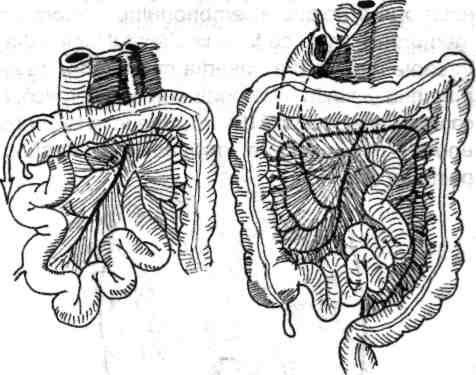 Ulterior dezvoltării colonului ascendent şi rotirii intestinului, se ajunge la dispoziţia finală cunoscută (fig. 1.4). 3.