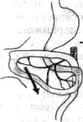 în continuarea intestinului mijlociu apare şi te intestinul posterior din care vor deriva: 1/2 stângă a colonului transvers, colonul descendent, colonul sigmoid şi cele 2/3 superioare ale rectului,