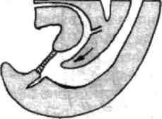 t2 Fig. 1.7- Secţiune sagitală a jumătăţii distaie a trunchiului la embrionul de 40 zile. la exterior şi endodermală spre cavitate.