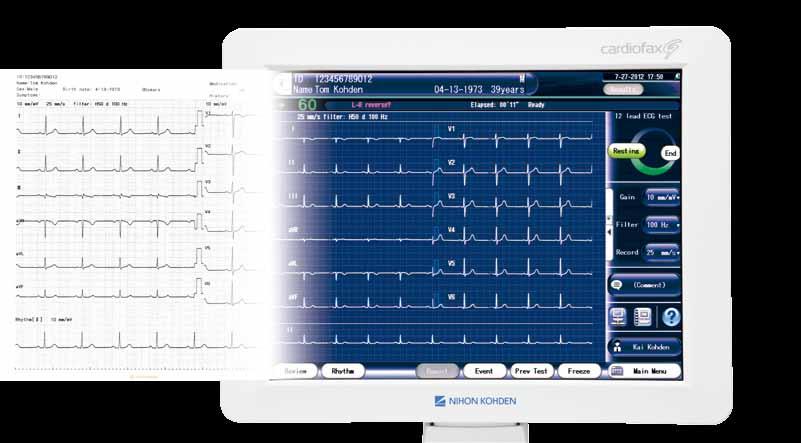 Safe and speedy To ensure efficient testing without needing to repeat the test, information can be checked on the ECG display