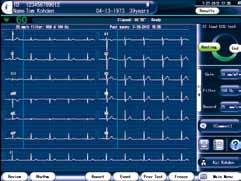 Reference Requesting physician s comments and past 12 lead ECG exams can be viewed onscreen at exam time.