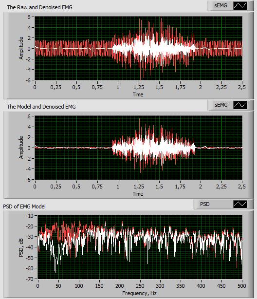 The simulated raw EMG signal The Denoised EMG signal a) The digital