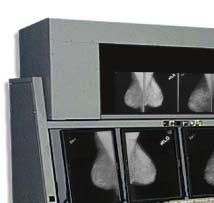 Mammography Digital
