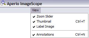 Set ImageScope Viewing Preferences You can set up your ImageScope viewing preferences the first time you open a digital slide with ImageScope (see Opening a Digital Slide on page