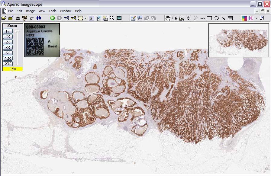 To quickly open a slide in ImageScope, click on the thumbnail of the Macro image.