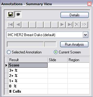 Run Image Analysis Aperio provides a new approach to IHC with an all digital solution.