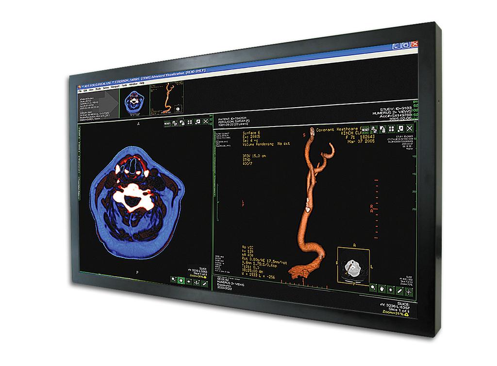 Surgical Large Screens 42 42 Surgical LCD for Operating Theaters Surgical Colour LCD MD-CP42AU-MED2 Size Surgical Colour LCD MD-CP42AUPG-MED 42 / 106.7 cm Active area (H V) 930.2 523.