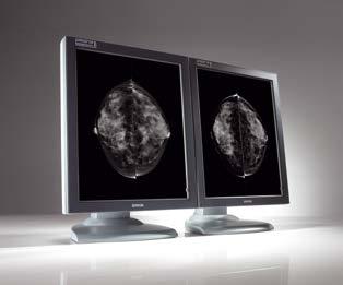 Coronis 5MP Mammo (MDMG-5121) 5 MegaPixel diagnostic display system for digital mammography The Coronis 5MP Mammo display system proves that technology can make a real difference.