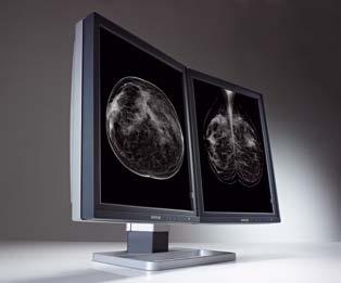 Mammo Tomosynthesis 5MP (MDMG-5221) 5 MegaPixel diagnostic display system for digital breast imaging Barco s Mammo Tomosynthesis 5MP has been developed to optimize reading and interpretation of