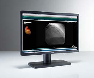 Eonis 22 black (MDRC-2122 BL) 22-inch clinical display with high-precision LCD Built with healthcare specialists in mind, this 22-inch clinical display combines high image quality, utmost precision,