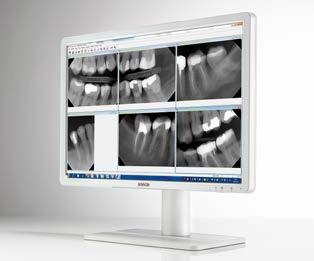Eonis 24 white (MDRC-2224 WP) 24-inch dental display with cleanable design This 24-inch dental display provides dentists with crisp, high-contrast dental images.