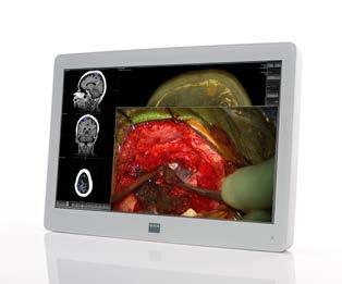 MDSC-2224 24-inch High Definition surgical color LCD display The MDSC-2224 is a 24-inch nearpatient surgical display, featuring full HD resolution and a wide color gamut.