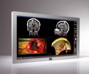 MDSC-2242 42-inch High Definition LCD display for the operating room The MDSC-2242 is a 42-inch large-screen surgical display with LED backlight, featuring full HD resolution.