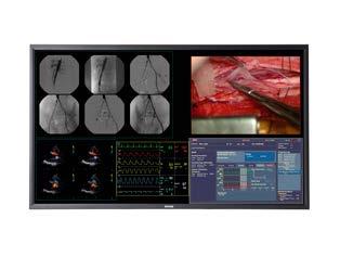 MDSC-8258 Slimline 58-inch Quad HD surgical display The MDSC-8258 is a large-screen surgical display with LED backlight, featuring a 58-inch LCD panel (16:9) with Quad HD resolution.