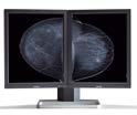 MaMMograpHy displays surgical MDMG-5121 MDMG-5221 SPECiFiCAtionS Coronis 5MP Mammo Mammo Tomosynthesis 5MP MDSC-1119 MDSC-2224 MDSC-2226 Diagonal size 21.3 21.