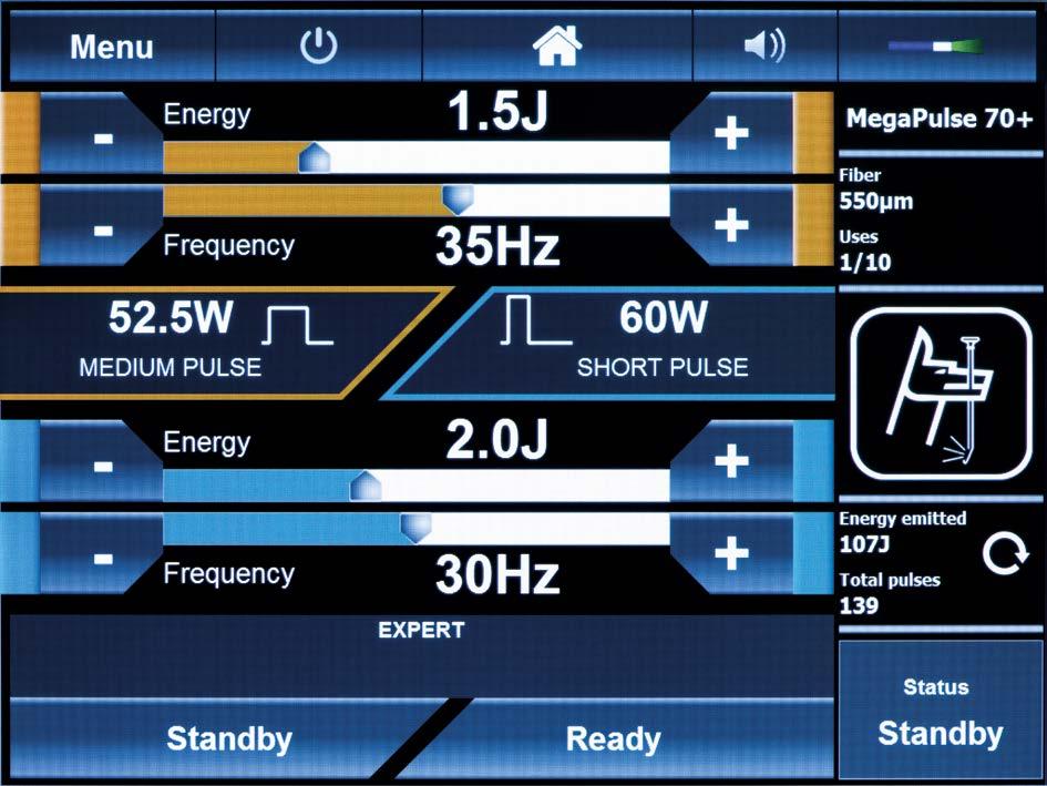Custom pulse selection EXPERT MegaPulse 70 + offers experienced users the option to select the pulse width in three stages short, middle