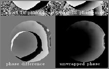 Magnetic Field Homogeneity Magnetic Field Homogeneity Phase images from GRE sequences with 10ms difference in TE s Phase and Unwrapped Phase Images The change in phase across the phantom is